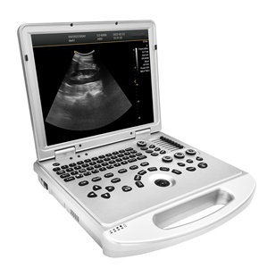 Ecógrafo Doppler Color Portátil de Alto Rendimiento Dawei DW-L3, Diseño Tipo Laptop para Diagnóstico en Hospitales Primarios - Product Image 5