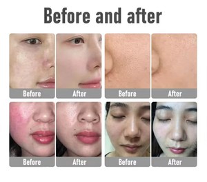 เครื่องสร้างออกซิเจนบนใบหน้าหัวปลั๊ก us/t/za O2เจ็ทฟื้นฟูผิวพร้อมหน้ากากโดมและสเปรย์ oxgen ฟอง - Product Image 2