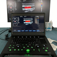 Système de diagnostic médical portable professionnel à échographie Doppler couleur haute exposition de 15,6 pouces pour clinique