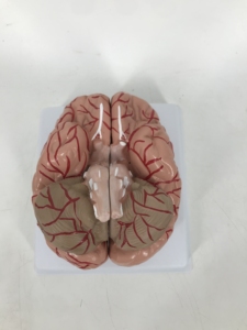 <strong>Brain</strong> Model with Arteries - Product Image 4