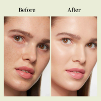 Meilleur visage toner pores minimiseur à base de plantes organique apaisant éclaircissant peau riz toner