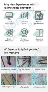 מוצרי חדשות 2024 עור שיער אנלייזר מנתח שיער, מנתח שיער מנתח מכשיר ניתוח עור מכונת יופי סלון - Product Image 6