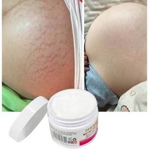 有机减少妊娠纹乳液身体紧致按摩美白护理怀孕肥胖线褪色溶液保湿霜 - Product Image 3