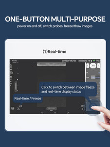 Mesin Diagnostik Terapi Ultrasound CONTEC CMS1600A Mesin Pemindai Ultrasound Portabel - Product Image 6