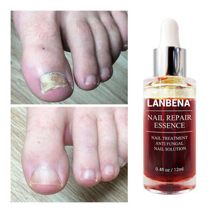 LANBENA 12 ml anti-hongos de <span class=keywords><strong>uñas</strong></span> solución de tratamiento - Product Image 2