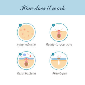 새로운 스타일 스타 여드름 패치 사용자 정의 된 모양 여드름 패치 방수 스팟 패치 마약 무료 - Product Image 3