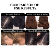 Ensemble de soins capillaires à l'huile d'argan marocaine sans paraben, marque privée, réparation intense, croissance des cheveux, traitement antipelliculaire