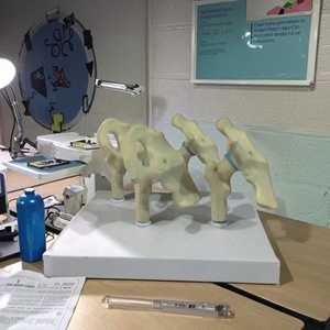 Modelo Anatómico de Cadera y <span class=keywords><strong>Rodilla</strong></span> Artrítica de 4 Etapas, Esqueleto de PVC, Modelo de Ciencia Médica para Educación Médica y Demostración - Product Image 2