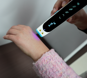 Máquina Láser Excimer Portátil Kernel 308P1 con LED de 308NM para el Tratamiento de Vitiligo, Psoriasis y Eccema - Product Image 1