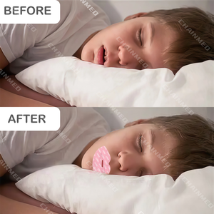 Cinta Bucal Anti-Ronquidos Premium Hipoalergénica y Transpirable con Logotipo Personalizado CM para Dormir con Antifaz - Product Image 4