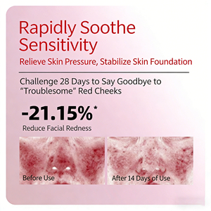 <span class=keywords><strong>Crema</strong></span> Rigenerante per <span class=keywords><strong>Pelle</strong></span> <span class=keywords><strong>Sensibile</strong></span>, Riparazione Barriera Cutanea, Lenitiva, Anti-Arrossamento, Idratante, <span class=keywords><strong>Crema</strong></span> Riparatrice OEM - Product Image 2