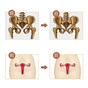 Capsules de réparation du plancher pelvien OEM, granules de 0,5 g, pour les soins post-partum et le resserrement vaginal - Product Image 1