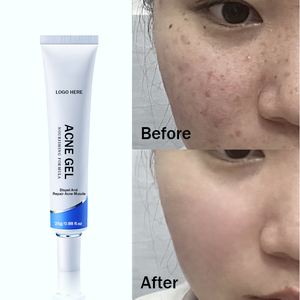 Gel anti-acné à l'<span class=keywords><strong>acide</strong></span> <span class=keywords><strong>salicylique</strong></span>, formule efficace, soin professionnel de la peau du visage, OEM/ODM - Product Image 3