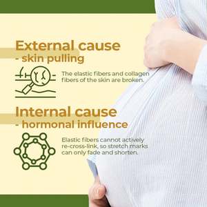 Aceite Corporal Nutritivo Orgánico al por Mayor para Eliminar Cicatrices Profundas, Tratamiento con Vitamina E para Combatir Granos, Acné y Estrías, Repara Todo Tipo de Piel - Product Image 4