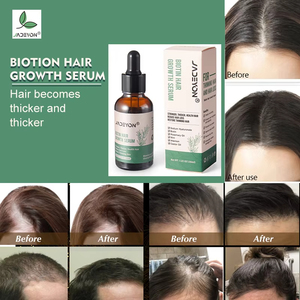 Personnalisé 100% Naturel Organique Marque Privée Essentiel Rapide Cheveux Sauvage Croissance Sérum Romarin Menthe Huile pour Femmes Noires Hommes - Product Image 6