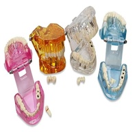 Modelo de Restauración Dental de PLA Transparente Azul para Enseñanza Oral, Marca Tianlian, Modelo TL