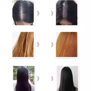 Nizo OEM 24 horas calmante Cuidado del cuero cabelludo champú Reino Unido Venta caliente para <span class=keywords><strong>eczema</strong></span> seco El cabello rizado propenso ofrece un alivio continuo suave y sedoso - Product Image 4