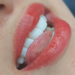อิโฮก้า ทีธ คัฟเวอร์ วีเนียร์ส สีขาว สำหรับใช้ในบ้าน ตกแต่งฟัน - Product Image 3