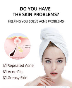 <span class=keywords><strong>Crème</strong></span> Visage à l'Acide Hyaluronique pour Peau Lisse Réduit les Pores Répare Rapidement les Cicatrices d'Acné <span class=keywords><strong>Anti</strong></span>-Taches Gel <span class=keywords><strong>Anti</strong></span>-Acné - Product Image 5