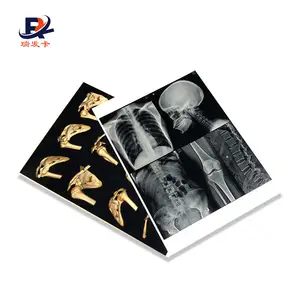 High Quality 8*10 Inch Blue Base Laser Printing X-Ray Medical Film