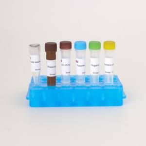 Kit de RT-PCR fluorescent universel pour grippe <span class=keywords><strong>aviaire</strong></span> H5 à double cible | Haute sensibilité pour H5N1/H5N8 et Pan-<span class=keywords><strong>Influenza</strong></span> A - Product Image 2