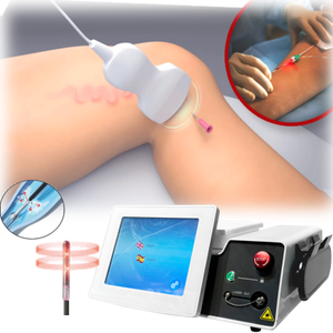 980nm 1470nm डायोड लेजर एंडोवेनस वेरीकाज़ नसों उपचार संवहवहनी लेजर 1470nm एन्डो लेजर रेडियल फाइबर डिवाइस - Product Image 1