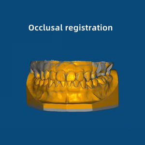Le <span class=keywords><strong>scanner</strong></span> automatique portable IFun <span class=keywords><strong>pour</strong></span> l'<span class=keywords><strong>impression</strong></span> <span class=keywords><strong>3D</strong></span> prend <span class=keywords><strong>en</strong></span> charge la connectivité USB du matériau PLA - Product Image 3