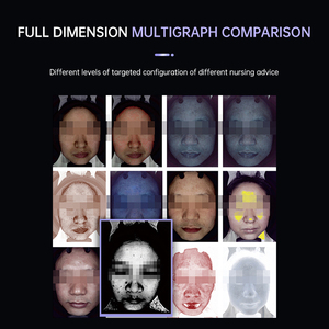 Máquina De Análise De Pele A6 Análise De Pigmentação 3D Máquina De Análise De Pele Portátil - Product Image 6