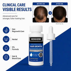 Siero Olio <span class=keywords><strong>per</strong></span> la Crescita dei <span class=keywords><strong>Capelli</strong></span> con Biotina 5% Trattamento Anticaduta Nutriente <span class=keywords><strong>per</strong></span> il Cuoio Capelluto <span class=keywords><strong>per</strong></span> Uomini e Donne Produzione OEM - Product Image 3