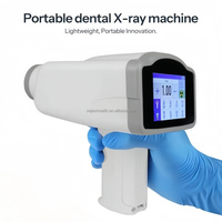 Système de dépistage aux rayons X, Appareil de radiographie portable, Scanner de bagages médical aux rayons X, Vente en gros Chine
