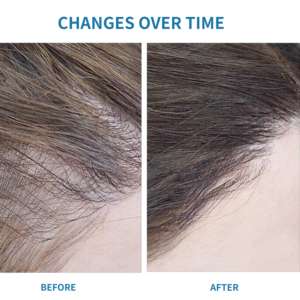 CHUSN Bitkisel Bakır Peptit Saç Yağı Kökleri Güçlendirir Kırılmayı Azaltır Folikülleri Uyarır Yeni Büyüme 2'si 1 Arada Formül Saç Dökülmesini Önler - Product Image 6