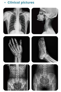 2025 popüler sabit <span class=keywords><strong>DR</strong></span> X ışını sistemi dijital radyografi floroskopi x-ray makinesi hastane ekipmanları - Product Image 6