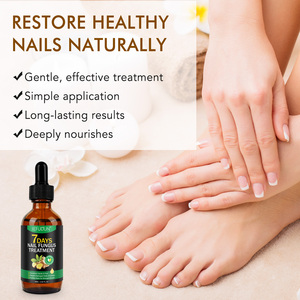 SEFUDUN Sérum Liquide de Croissance au Gingembre pour Mycose des Ongles 7 Jours, Service OEM, Répare les Ongles Cassants, Nourrit les Cuticules, Vente en Gros Disponible - Product Image 3
