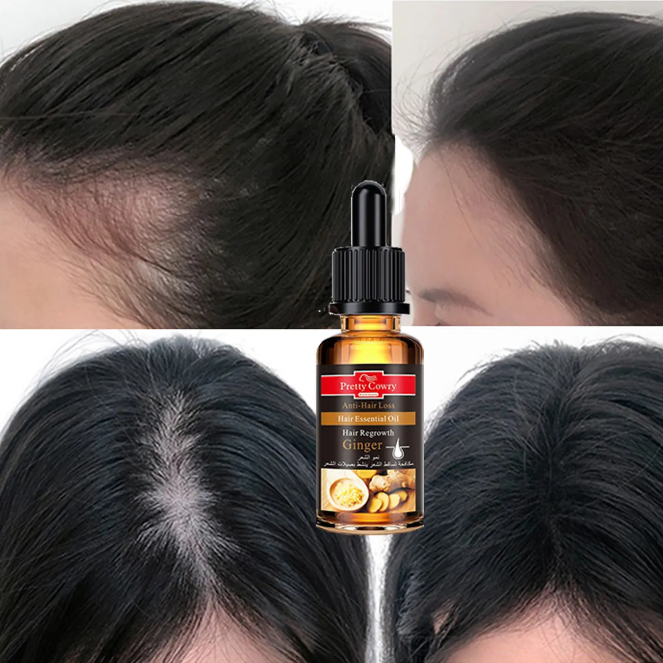 7 Day Hair Treatment Pretty Cowry Best Ginger Hair Regrowth Product Organic  Hair Growth Oil - Buy 7 Days Hair Growth Ginger Essence,7 Days Hair Growth  Ginger,Hair Growth Treatment Ginger Essence Hair