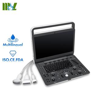 Échographe Doppler Couleur Portable SonoScape E2 avec Sonde Convexe, Source d'Alimentation Électrique, en Vente - Product Image 1