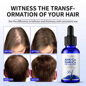 OEM/ODM 1% GHK-Cu+AHK-Cu Hair Growth serum Nourishing Fragile Hair Strands <b>Volumizing</b> Anti Breakage peptide hair growth serum - Product Image 3