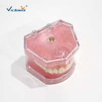 Modelo de Extracción Dental con 28 Dientes Removibles y Encías Suaves M7008 para Entrenamiento de Cirugía Oral, con Certificaciones CE, ISO, ROHS y CNAS