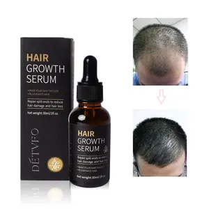 Anti loss best fast hair growth oil serum alopecia hair loss treatment products organic herbal ginger regrowth oil set