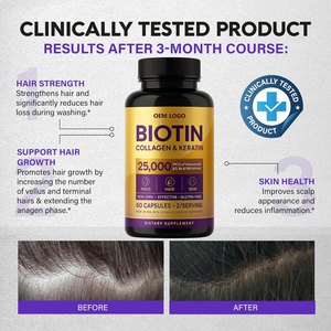 Clínicamente probado soporte para el crecimiento del cabello piel uñas complejo 25000 Mcg cápsulas biotina colágeno queratina suplemento para adultos - Product Image 5