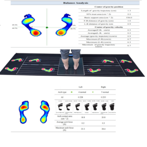 Analizador de Presión Plantar para Impresora de Plantillas Ortopédicas, Escáner de Presión del Pie, Impresora 3D para Fabricar Plantillas Ortopédicas - Product Image 1