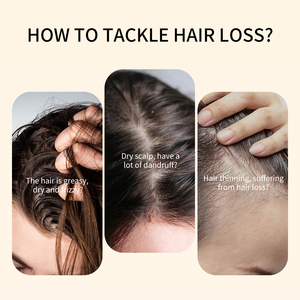 Shampoing et Après-Shampoing de Marque Blanche Naturel Végétalien à l'Oignon, au Romarin et à la Biotine, Sans Sulfates, pour la Croissance Capillaire - Product Image 2