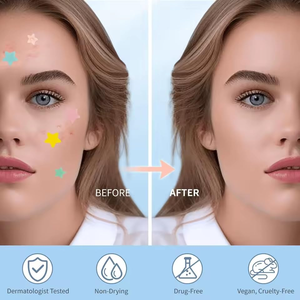 Parches Hidrocoloides de Cúrcuma para el Acné y las Espinillas con Vitamina E y Ácido Hialurónico para Hidratar y Curar la Piel Normal del Rostro - Product Image 3