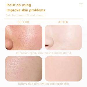 Máscara Facial de Argila Herbal com Vitamina C e Arbutin, Anti-idade, Clareadora, Hidratante e Esfoliante, com Pó de Cúrcuma para Pele Feminina - Product Image 4