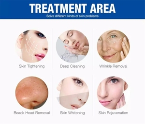 Appareil multifonctionnel d'élimination de l'acné, d'hydrothérapie faciale à l'eau et à l'oxygène, de peeling, de nettoyage en profondeur et de blanchiment - Product Image 6