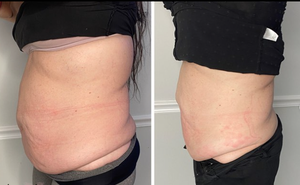 El más nuevo láser 6D Lipo <span class=keywords><strong>Laser</strong></span> Sin <span class=keywords><strong>Cirugia</strong></span> Lipolaser Resultados Terapia de luz roja Fat Melt Slimming - Product Image 3