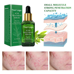 Özel etiket saf doğal çay ağacı yağı akne tedavisi yüz Serum glikolik asit laktik sivilce sökücü akne karanlık noktalar Serum - Product Image 2
