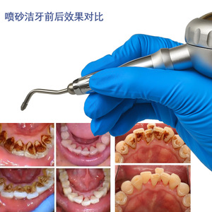 Unidad de Profilaxis Dental Xp Airflow con Luz LED para Limpieza Dental y Blanqueamiento de Dientes - Product Image 2