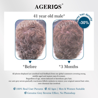 Serum Anti Uban Non-Pewarna, Esens Rambut Putih ke Hitam, Palmitoyl Tetrapeptide-20, Mengaktifkan Melanin, Mengembalikan Warna Rambut Alami