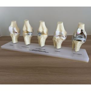 Kyrenmed รูปแบบการรักษาโรคข้อเข่าเสื่อม, แบบจำลองการรักษาโรคข้อเข่าเสื่อม5ขั้นตอน - Product Image 5