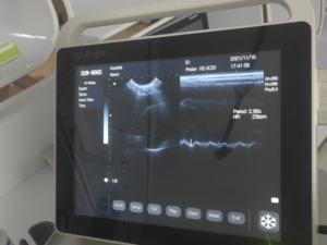 SUN-800S 15 Inch Touchscreen Echografie Medische Draagbare Dierlijke Gebruik Echografie Scan Machine Met Hoge Resolutie - Product Image 2